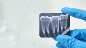IA para dentistas atrai Triaxis, Crescera e cofundador da Odontoprev